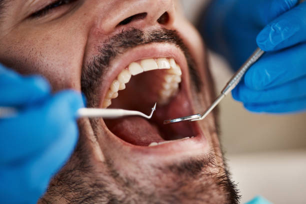 Best Cosmetic Emergency Dentistry in Kootenai, ID